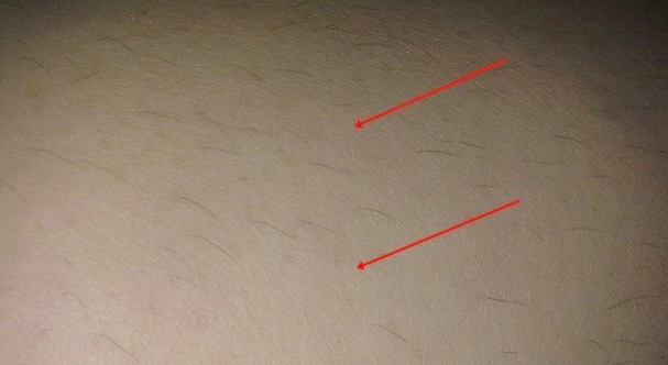 cách tẩy lông bằng máy wax